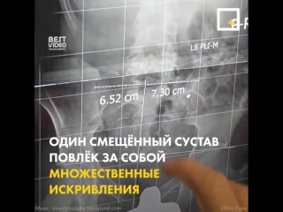 free мун не чувствовал ног и все остальные врачи отказались помочь ему hd