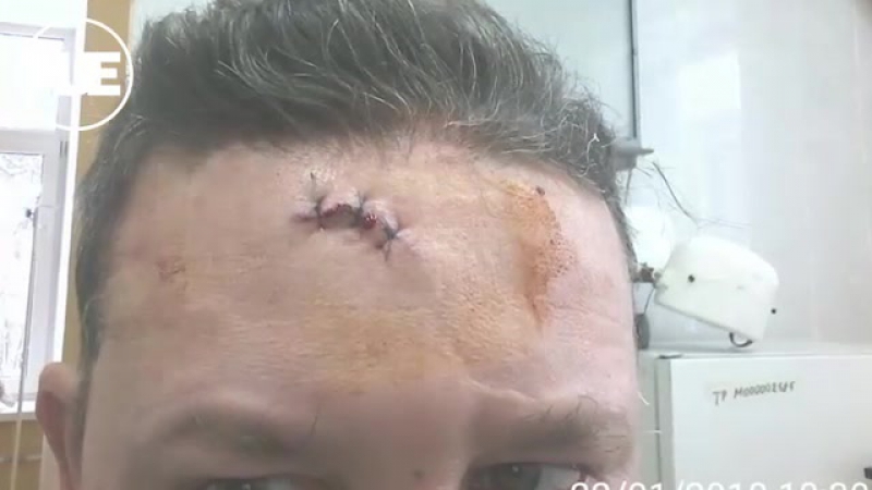 free неадекватный житель снт ручеек в люберцах избил председателя правления за неверный счет за свет hd