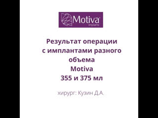 free результат операции с имплантами разного объема hd