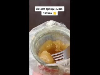 free если на пятках появились трещины существует несколько способов их лечения и предотвращения hd