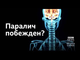 free ученые из австралии смогли вылечить паралич рук и кистей hd