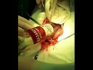 free мужчина засунул в анальное отверстие стеклянную литровую бутылку а вытащить обратно уже не смог удивлены были даже hd