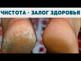 free пятки в порядке простые шаги к мягкой коже и здоровым ногам hd