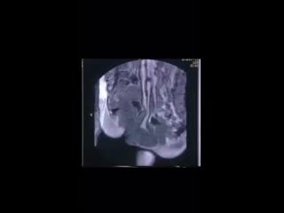 free секс во время мрт необычный эксперимент проведенный 20 лет назад доктором тони деламотом опубликован в bmj hd