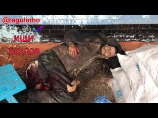 free всушник попал в плен после того как ему оторвало ногу строго 18 hd