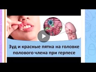 free зуд и красные пятна на голое полового члена при герпесе hd