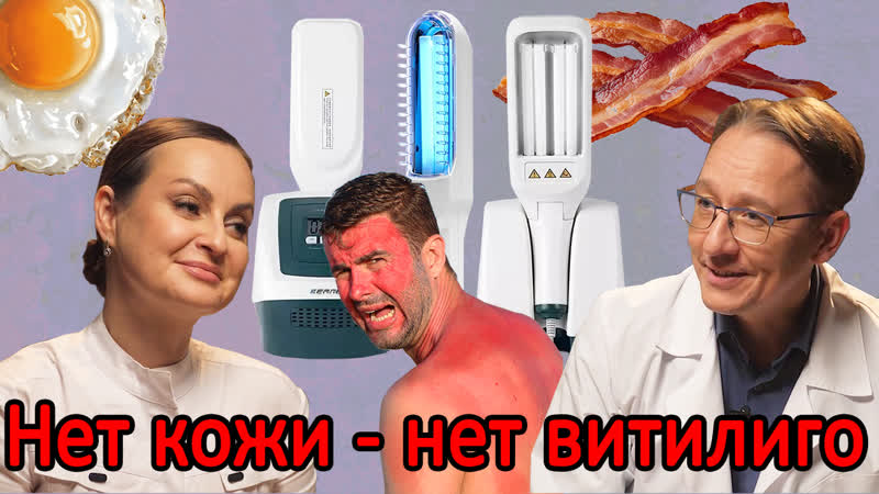 free обзор лампы 311 и лампы вуда облучаться или нет опасность рядом отзывы hd
