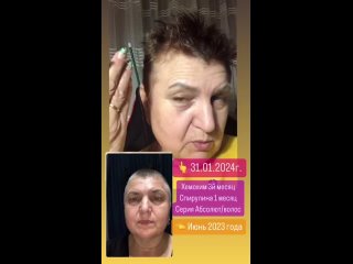 free отзыв на шампунь абсолют от атоми девчонки уже спросили это реально твои седые волосы hd