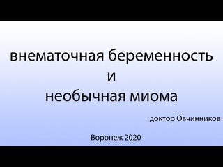 free внематочная беременность и необычная миома матки hd