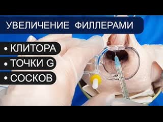 free увеличение клитора точки g сосков филлерами контурная пластика гиалуроновая кислота hd