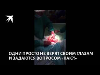 free шок контент врачи петербурга достали из пациента гигантское дилдо и выложили видео в сеть hd