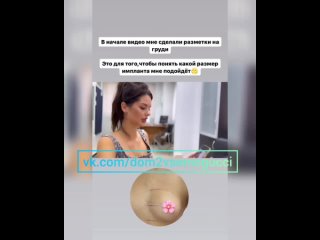 free анна самонина поменяет натуральный бюст на импланты третьего размера hd