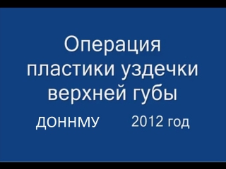 free операция пластики уздечки верхней губы френулопластика при диастеме молодые стоматология hd