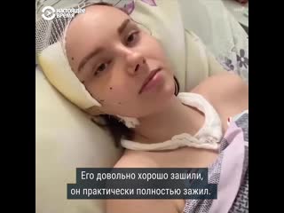 free пострадавшая во время протестов в минске уже месяц в больнице hd