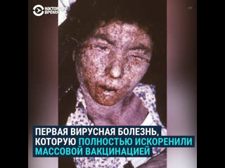 free как массовая вакцинация победила оспу от которой умирали сотни миллионов людей hd
