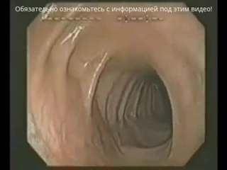 free очищение кишечника в домашних условиях от шлаков и токсинов домашнее очищение организма препараты для очистки hd