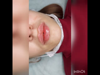 free видео от косметология массаж лазерная эпиляция донецк hd