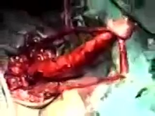 free хирургия операция по смене пола hd