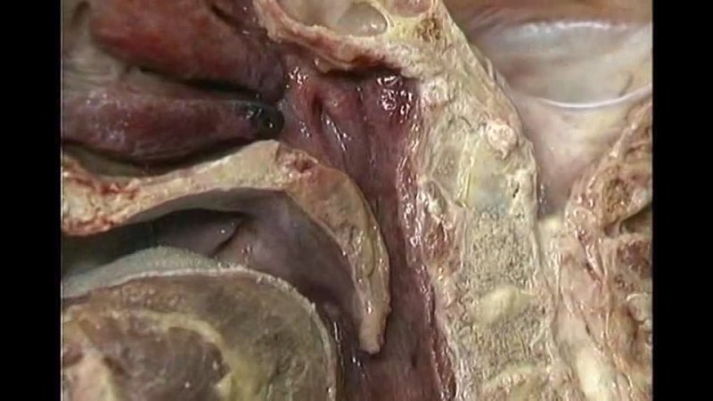 free mulut aclands dvd atlas human anatomy 4of6 head and neck part 1 mp3 wogre hd