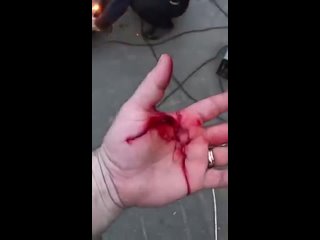 free сергей зарагулов у привитых частая причина смерти тромбоз и инфаркт mp4 hd