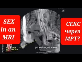 free вам интересно как выглядит секс через аппарат мрт hd