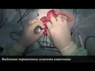 free резекция и анастомоз кишечника у кота intestinal resection in cat hd